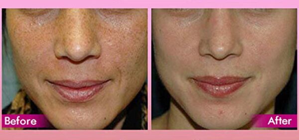 Planet Eden Youthful Glow 50% Glycolic Acid Peel with Free Treatment Fan Brush- Full Strength Cosmetic Grade Unbuffered - Image 2