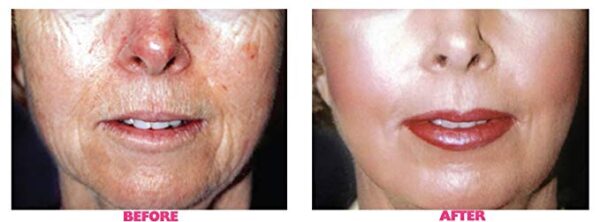 Planet Eden Intense Repair 88% Lactic Acid Skin Peel with Free Fan Brush - Unbuffered Professional Grade - Revive Sun Damaged Skin Quickly - Image 2